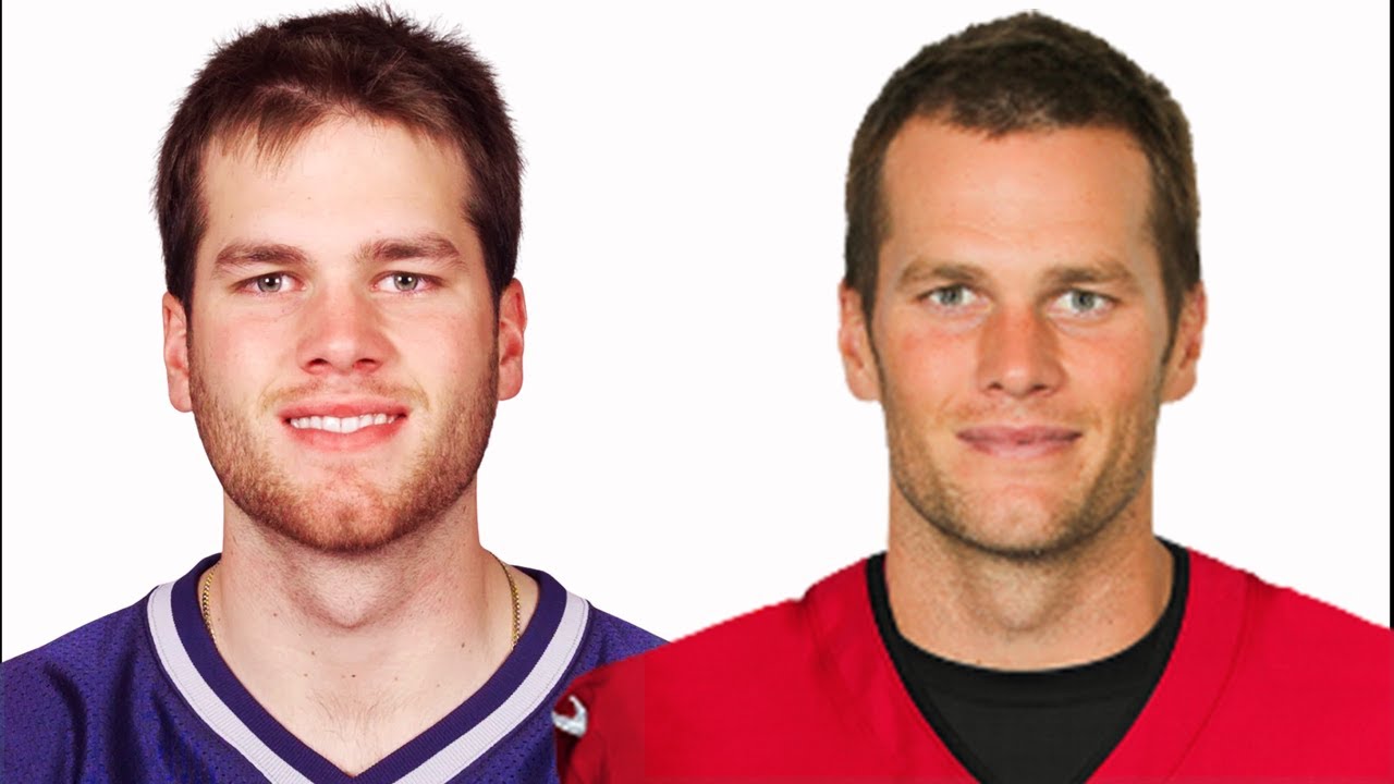 Here are some other reactions by fans to Tom Brady's plastic surgery
