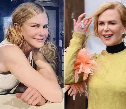 Nicole Kidman Plastic Surgery Nicole Kidman Plastic Surgery