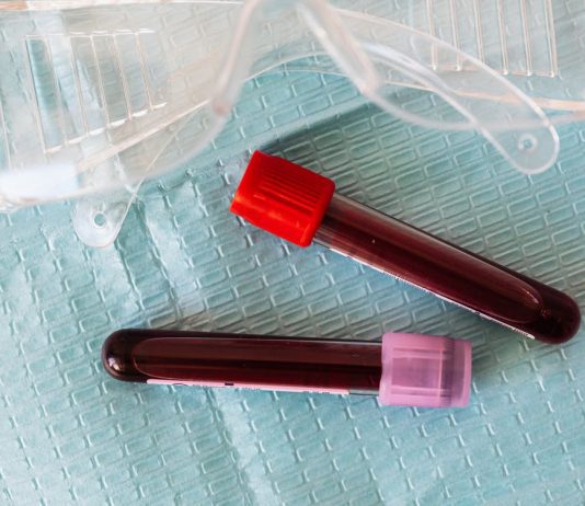 What Is Cord Blood Banking, And What Are The Costs Blood Banking