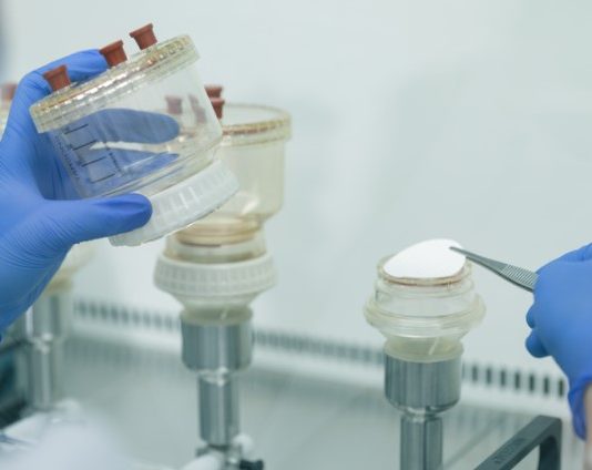 Bioburden Testing and Its Importance to the Manufacturing Process Bioburden