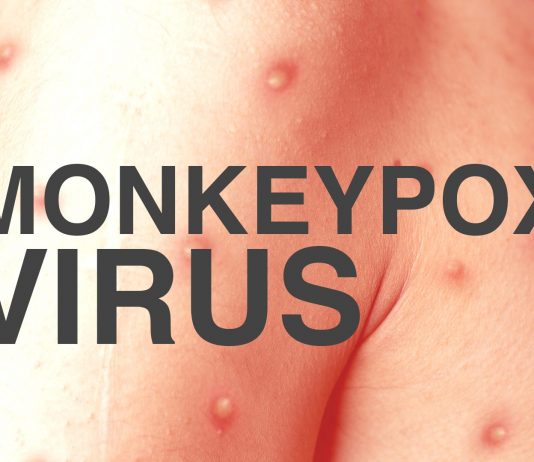 Monkeypox Singapore Monkeypox Singapore