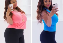 The Long-Term Success of Gastric Sleeve Surgery: What You Need to Know