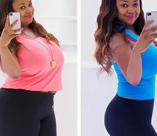 The Long-Term Success of Gastric Sleeve Surgery: What You Need to Know
