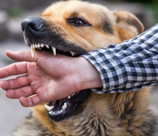 The Role of a Dog Bite Lawyer in Philadelphia